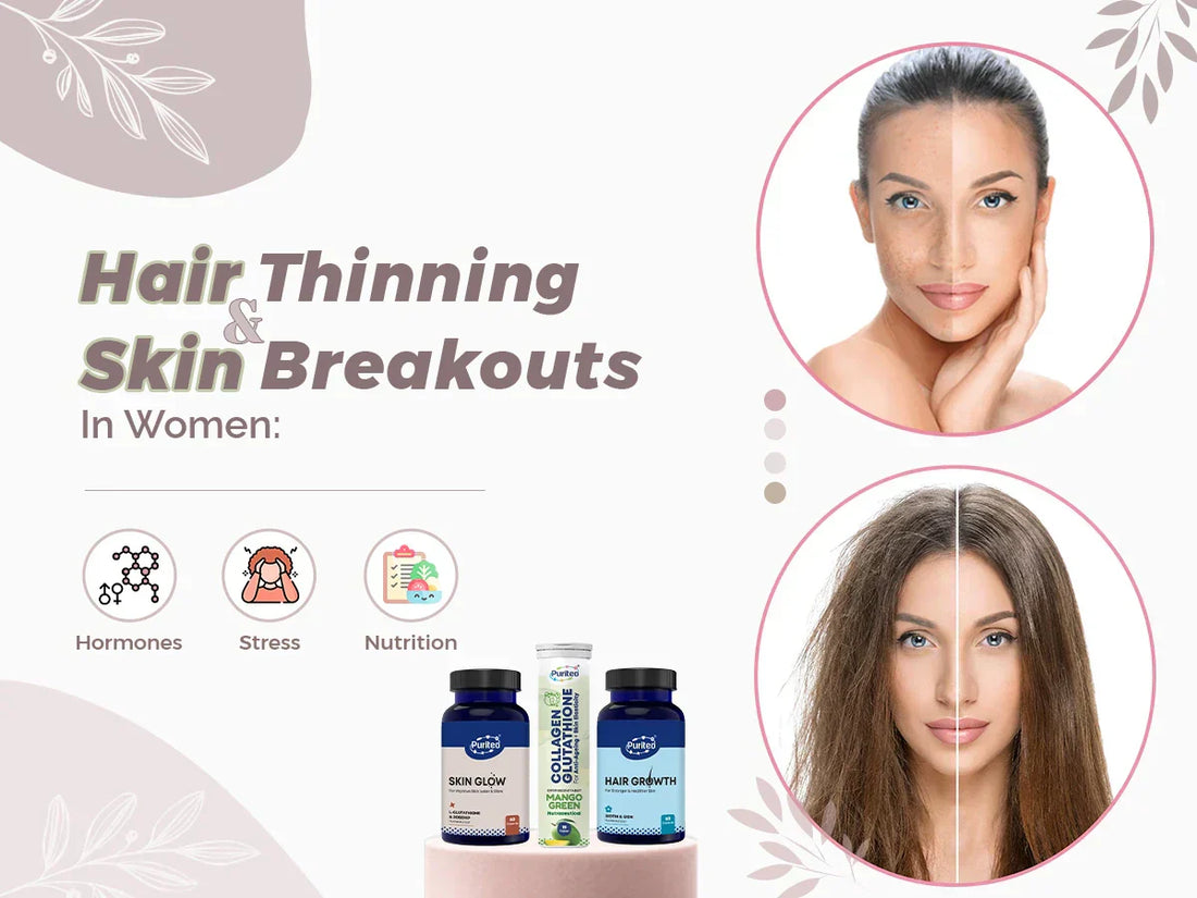 Hair Thinning & Skin Breakouts in Women: Hormones, Stress or Nutrition?